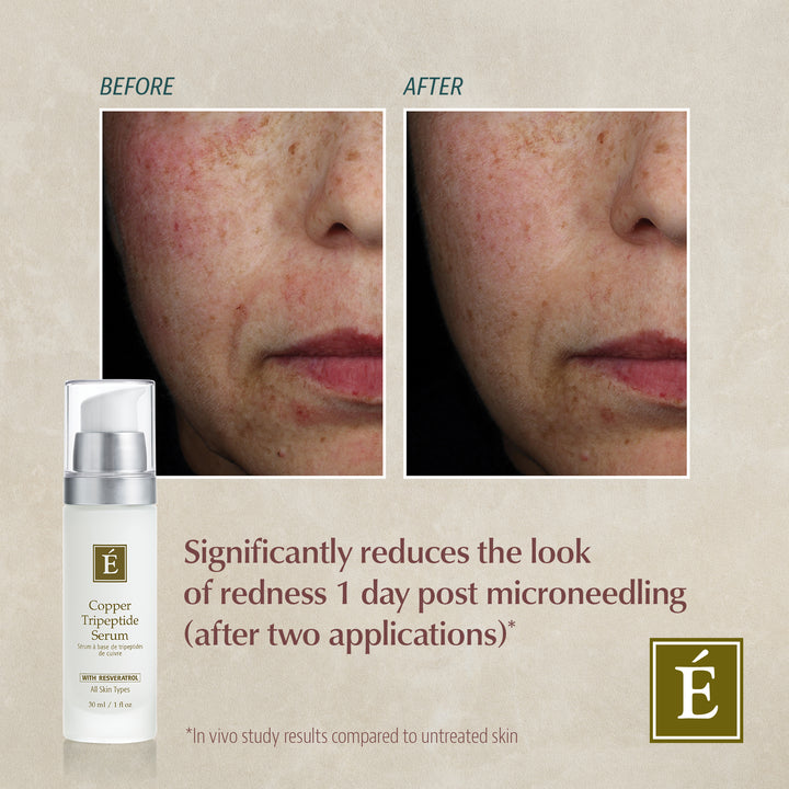 Before and after comparison of skin with Eminence Organics Copper Tripeptide Serum product displayed.